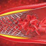Medical blog image