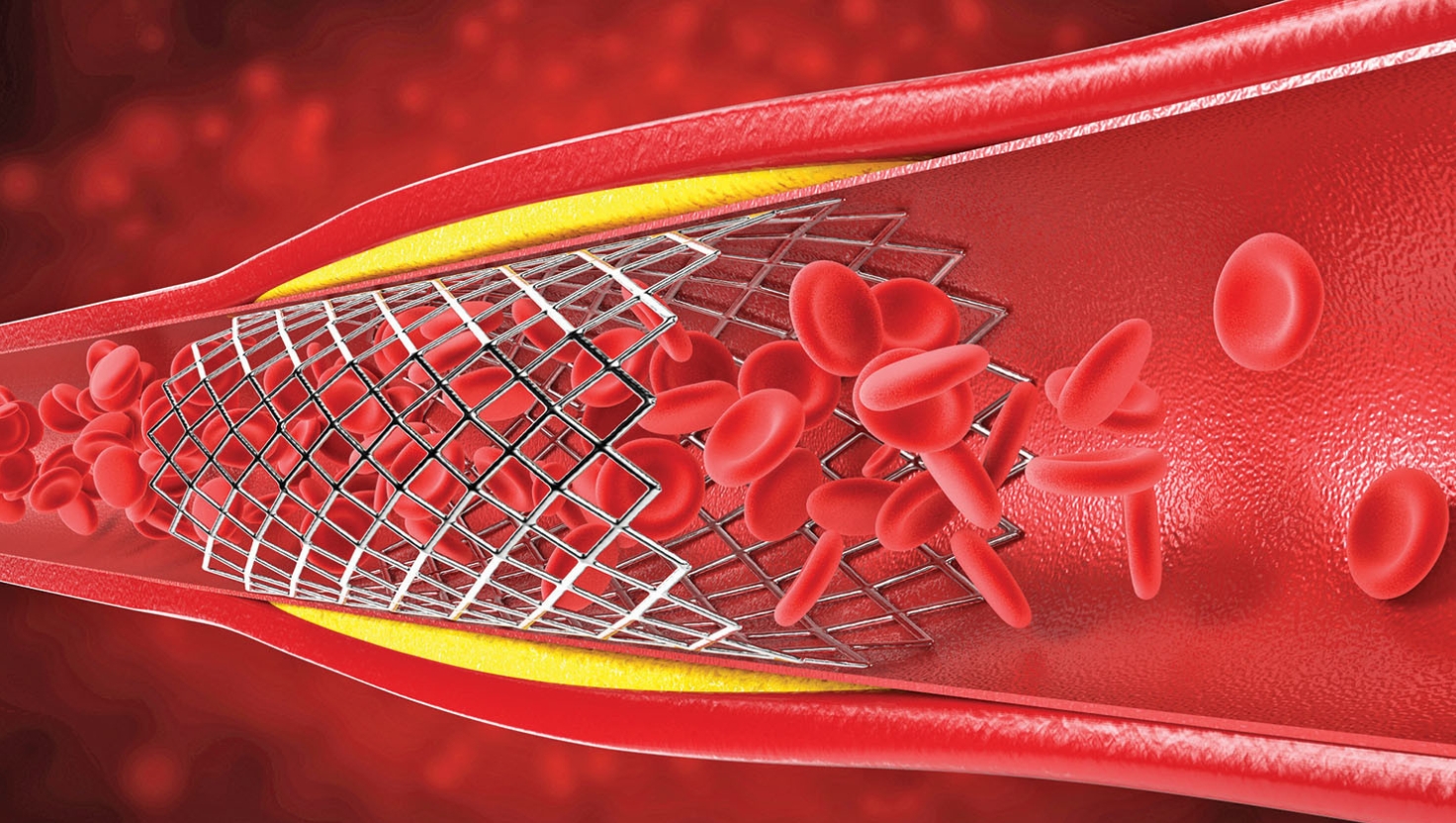 Medical blog image